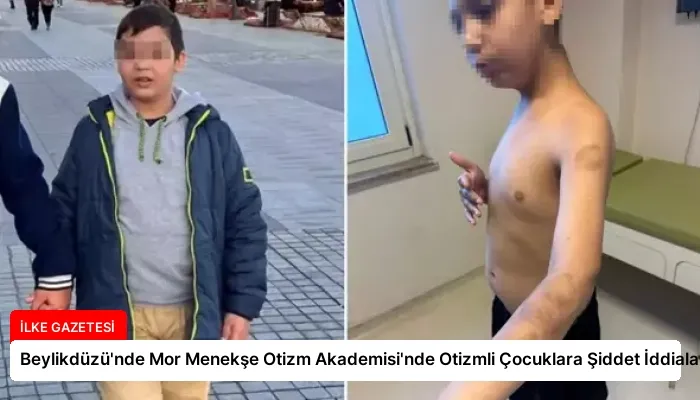 Beylikdüzü’nde Mor Menekşe Otizm Akademisi’nde Otizmli Çocuklara Şiddet İddiaları