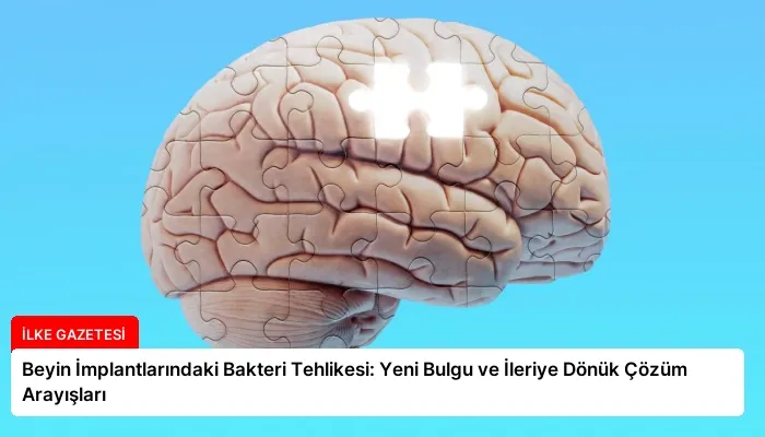 Beyin İmplantlarındaki Bakteri Tehlikesi: Yeni Bulgu ve İleriye Dönük Çözüm Arayışları