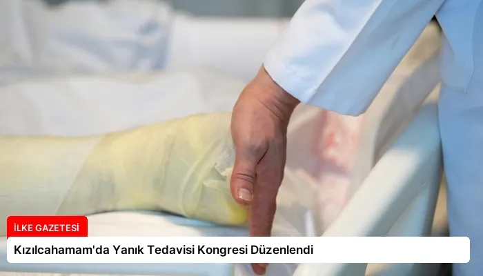 Kızılcahamam’da Yanık Tedavisi Kongresi Düzenlendi