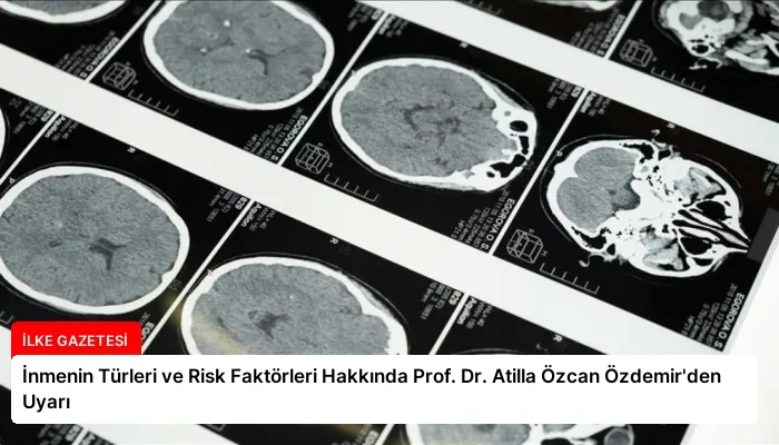 İnmenin Türleri ve Risk Faktörleri Hakkında Prof. Dr. Atilla Özcan Özdemir’den Uyarı
