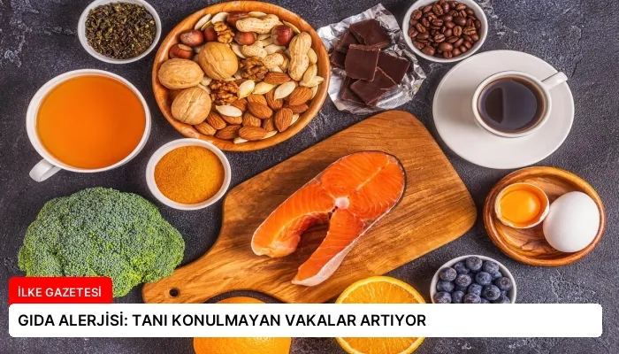 GIDA ALERJİSİ: TANI KONULMAYAN VAKALAR ARTIYOR
