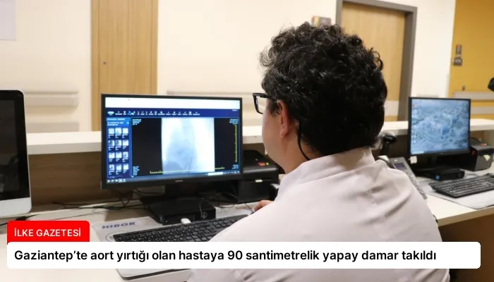 Gaziantep’te aort yırtığı olan hastaya 90 santimetrelik yapay damar takıldı